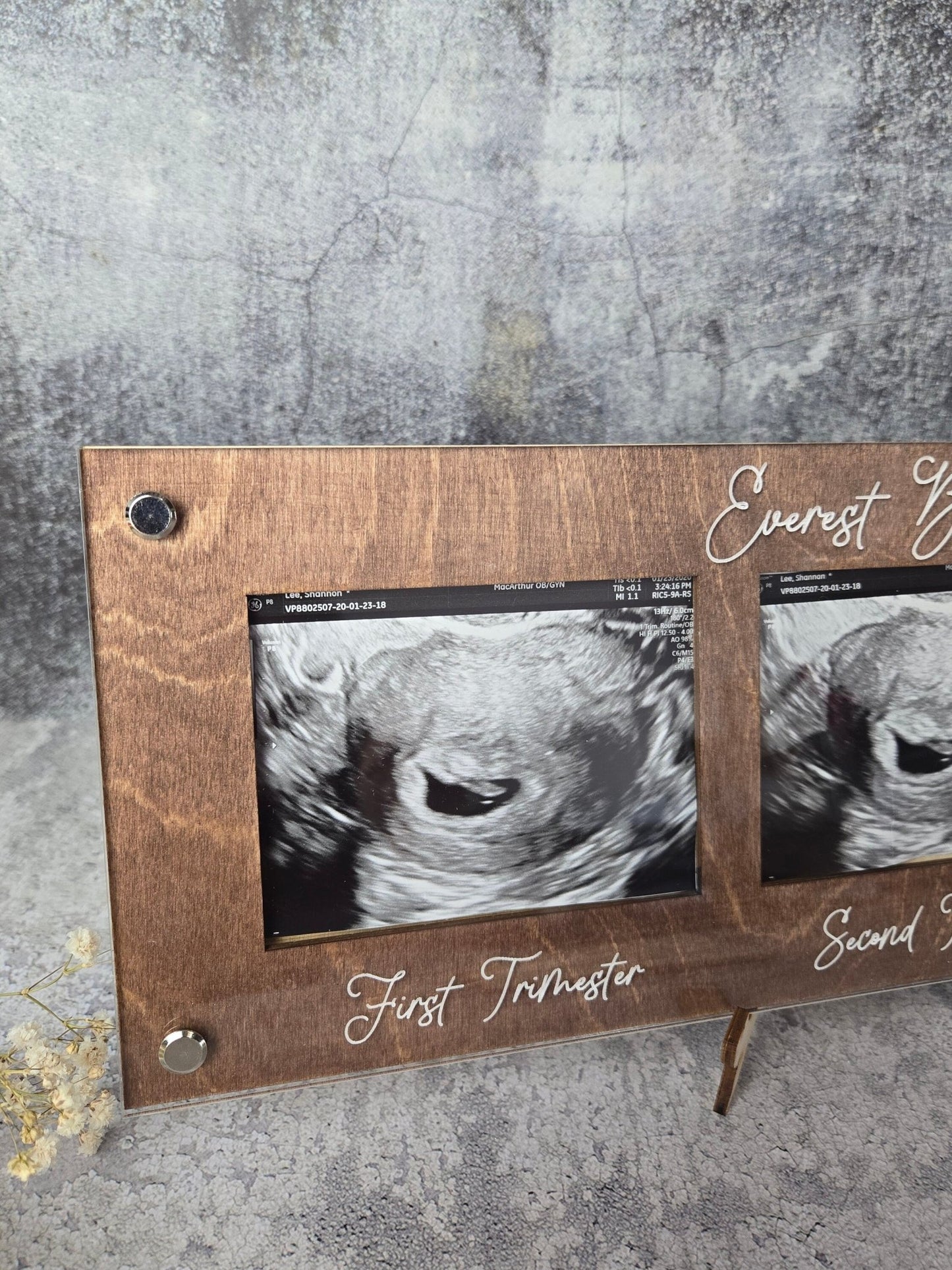 Ultrasound Picture Frame 1st-3rd Trimester - EverLee Creations