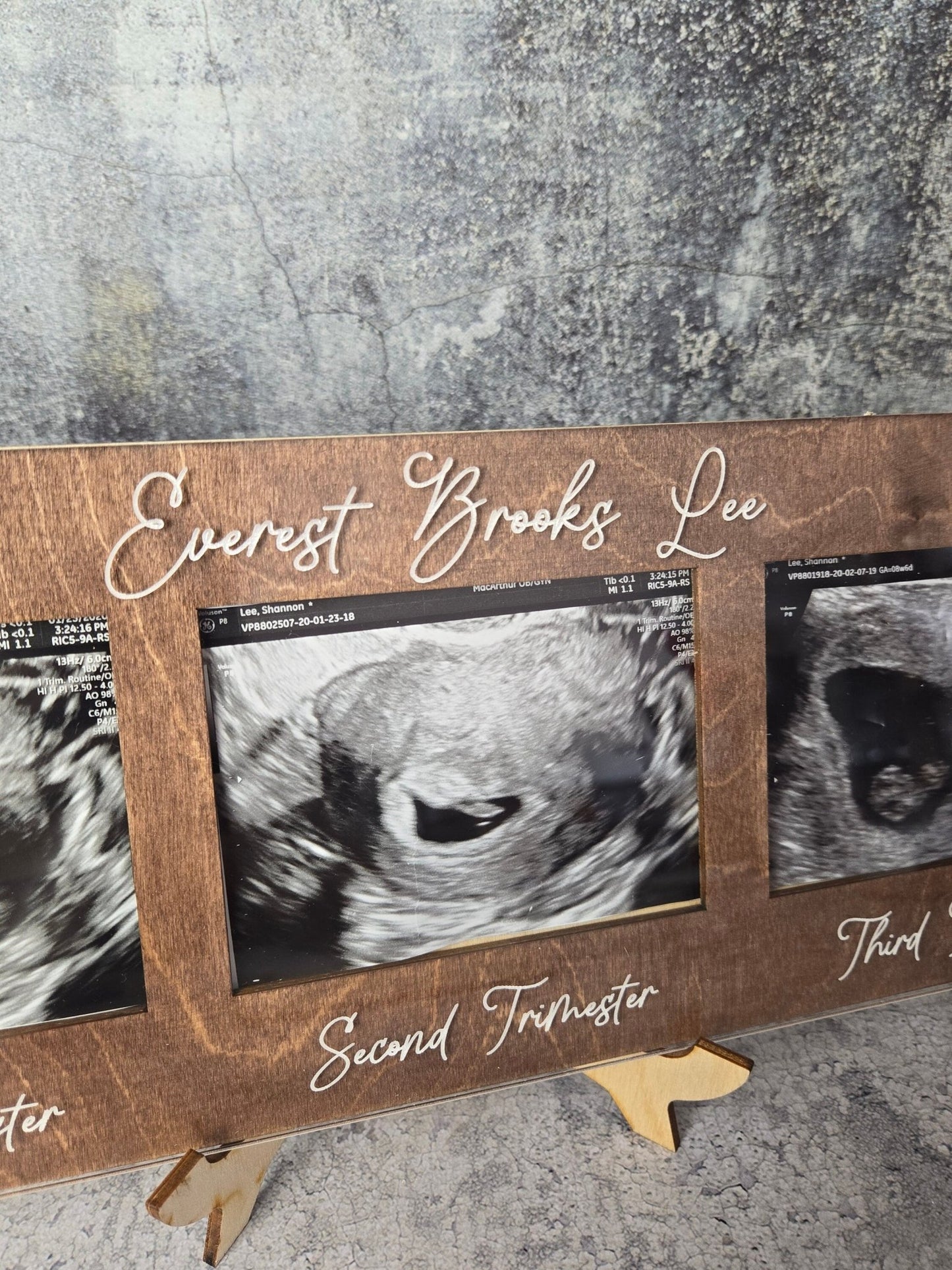 Ultrasound Picture Frame 1st-3rd Trimester - EverLee Creations